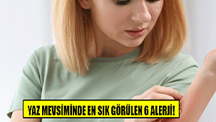 YAZ MEVSİMİNDE EN SIK GÖRÜLEN 6 ALERJİ!