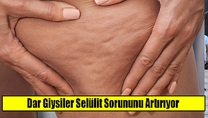 Dar Giysiler Selülit Sorununu Artırıyor