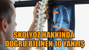 SKOLYOZ HAKKINDA DOĞRU BİLİNEN 10 YANLIŞ
