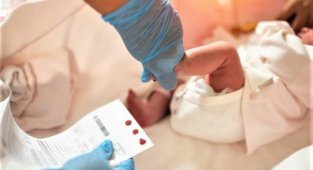 KKTC’de ilk kez SMA taşıyıcılık testi yapılmaya başlandı