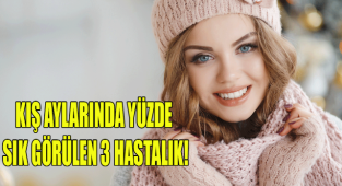 KIŞ AYLARINDA YÜZDE SIK GÖRÜLEN 3 HASTALIK!