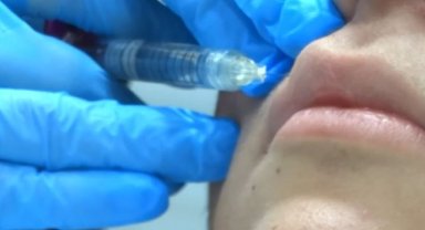 Medikal Estetiğin Gözdesi Dolgu Uygulamaları